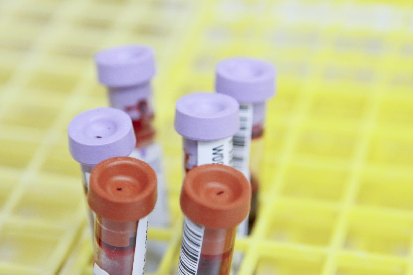 WSU researcher analysing samples in a Nairobi laboratory